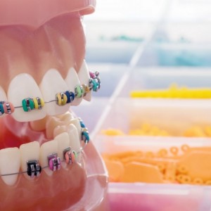 İstanbul Diş Hekimi - MsC Aydın Bilge - Ataşehir Pendik Diş Hekimi